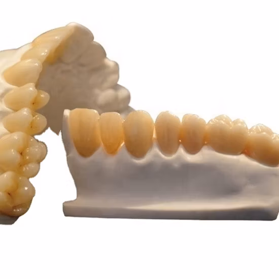 Dentadura material dental que processa blocos Multilayer da zircônia do disco cerâmico da zircônia